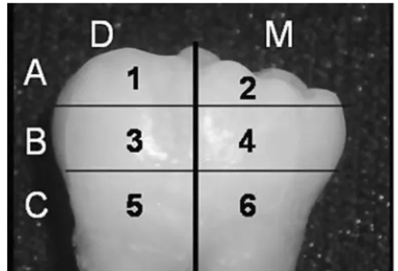 Table 1 Average, standard deviations and frequencies of LFpen readings for both tips in cuspal (A), middle (B), cervical (C), mesial (M) and distal (D) areas