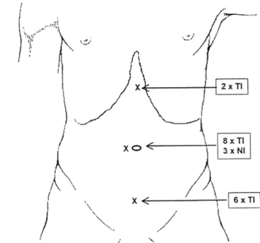 Table 3.  Trocar injuries