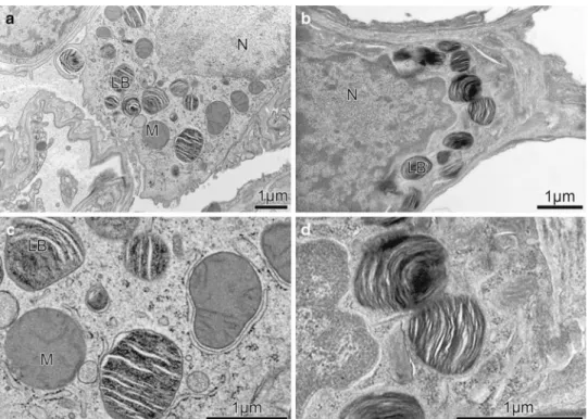 Fig. 1 Comparison of high- high-pressure  frozen/freeze-substitut-ed type II alveolar epithelial  cells (Group B; a, c) with  chem-ically Wxed samples (Group A; 