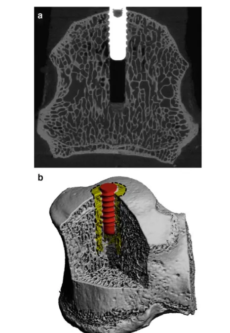 Fig. 1 a µ CT grayscale image showing the thin trabecular bone structures, the drill canal, the implant as well as the implant bone interaction