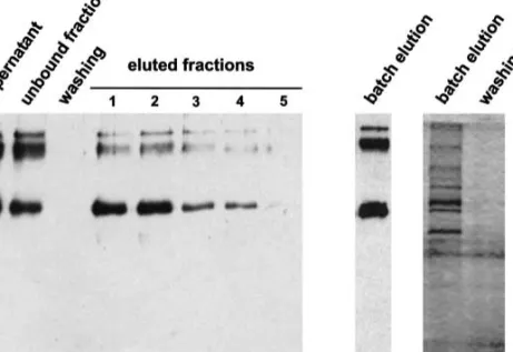 Fig. 5. Puriﬁcation of 6His NaPi-IIb by Ni-NTA aﬃnity chromatography.