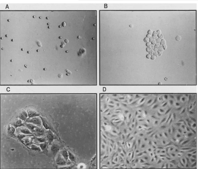 FIG.  1.  Four  steps  of  lung  microvascular  endothelial  cell  (MVEC)  isolation.  A,  Cell  suspension  after  digestion  with  trypsin  and  collagenase; B, induction of MVEC aggregates by plasma; C, formation of MVEC colony after a 3-d culture; D, p