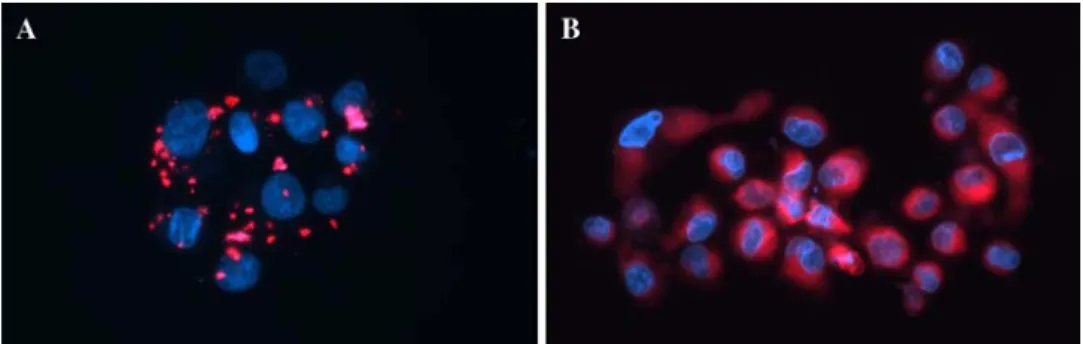 Fig. 5 Accumulation of tetranuclear arene ruthenium porphyrin compounds in human Me300 melanoma cells by fluorescence microscopy