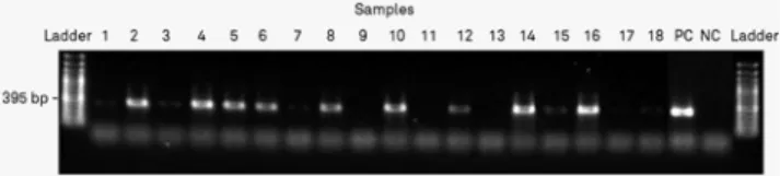 Figure 2. Results of the tagged primer PCR for the detection of DWV –RNA (NC = negative control, PC = positive control, PW = Pooled Workers, Ladder = size marker 100 bp peqlab)