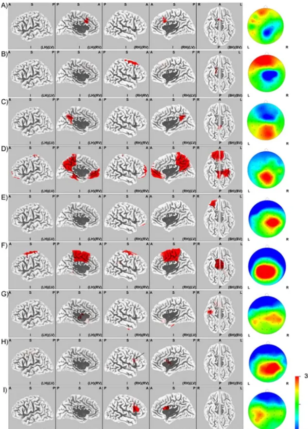 Figure 5. Localisation. Source modelling (using LORETA) for the significantly different scalp distributions between “early”