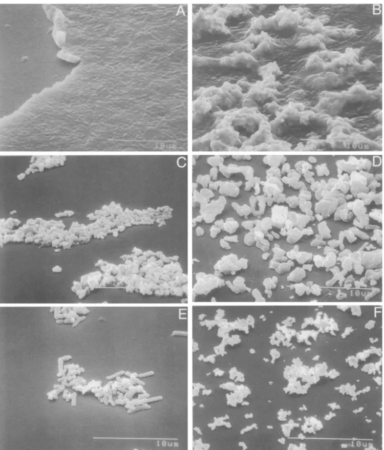 FIG. 3.  Scanning electron  micrographs of macrocarriers  that contain different particle  preparations:  A, Aqueous-dried  bacteria without  tungsten, B, Aqueous-dried  bacteria with tungsten,  C, Ether-dried  bacteria with tungsten,  D, Spray-dried  bact