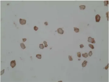 Fig. 4 Transfection of cell line HImo with the pCMV5-HLXB9 expression vector resulted in HB9 expression