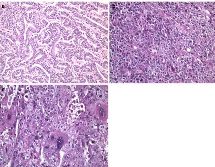 Table 6 Immunohistochemical stainings for CK7 and CK19 in HCC samples found upregulated for HLXB9