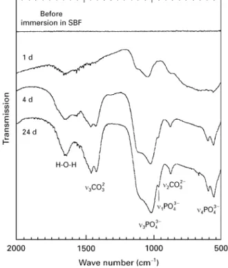 Figure 7 Calcium- and phosphorus-concentration of the untreated and NaOH-treated VPS-Ti coatings during immersion in SBF.