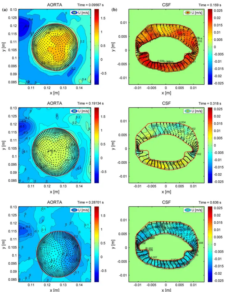FIGURE 7. Three time instances of the interpolating surface fits, the bounding polygonal contours and the mapped faces centers in the measurements plane for: (a) the aortic case and (b) the CSF case.