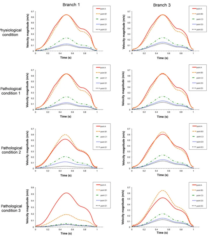 FIGURE 4. Velocity magnitude distribution in arterial tree in points defined in Fig. 1.