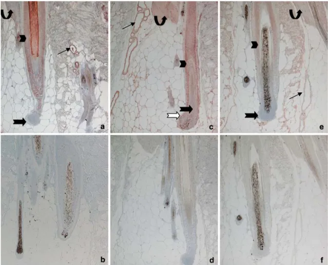 Fig. 5 a Immunohistochemical labeling for the GnRH-receptor in the canine skin. Note the strong staining of the upper portion of the outer root sheath (arrow head), the sweat glands (small  ar-row) and the arrector pili muscle (curved arar-row)