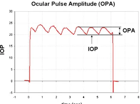 Fig. 1 Ocular pulse wave con- con-tour as measured by dynamic contour tonometry. The device displays the diastolic readings as intraocular pressure (IOP), and the difference between the means of systolic and diastolic readings is furnished as ocular pulse 