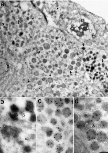 Fig. 5 α1-PI was detected in multiple secretory compartments of glucagon-producing cells