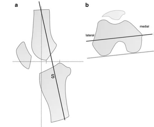 Fig. 3 Schematic drawing illustrates the measurement techniques for obtaining the joint space width and the joint opening angle