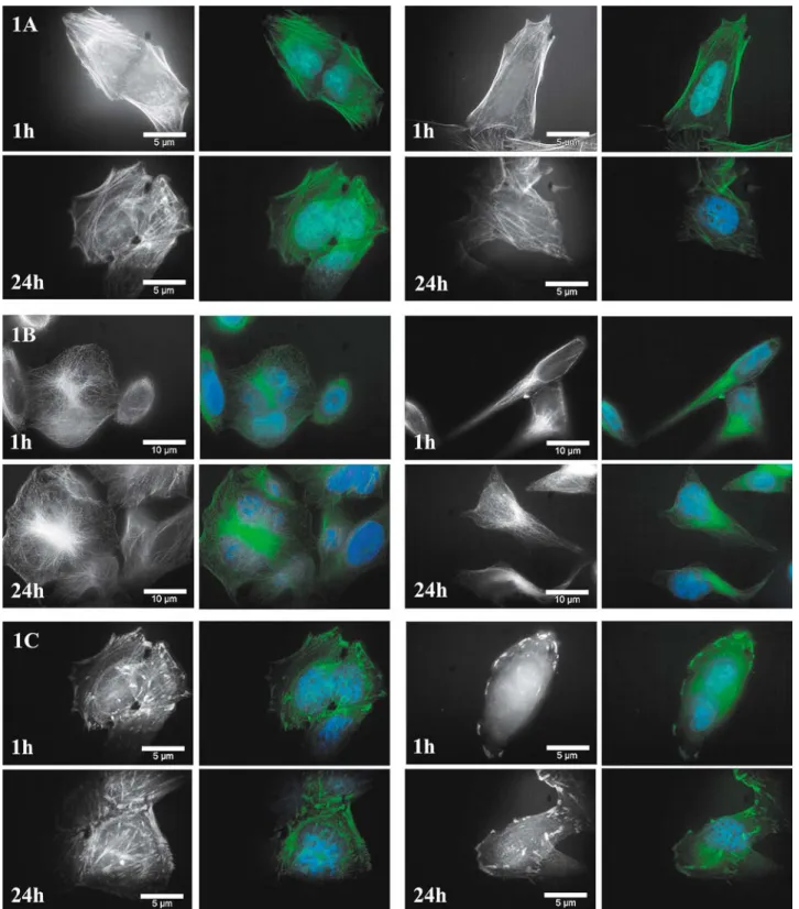 Fig. 1. Immunofluorescence images of F-actin (A),  -tubulin (B), and vinculin (C) in cultured J-111 cells