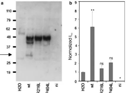 Fig. 4 Functional analysis of the R216L mutant in Xenopus oocytes. Oocytes were injected with rat ENaC subunits in the presence of water (H 2 O, lane 1), TMPRSS3 wild type (wt, lane 2), or missense mutations (R216L, lane 3 and P404L, lane 4)
