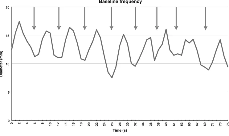 Fig. 4 Plot of baseline motility before the administration of an antiperistaltic drug (20 s)