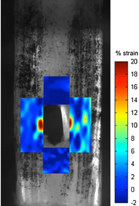 Fig. 1 Strain profile in a loaded tendon with a central defect. Red represents the largest strain possible in this model