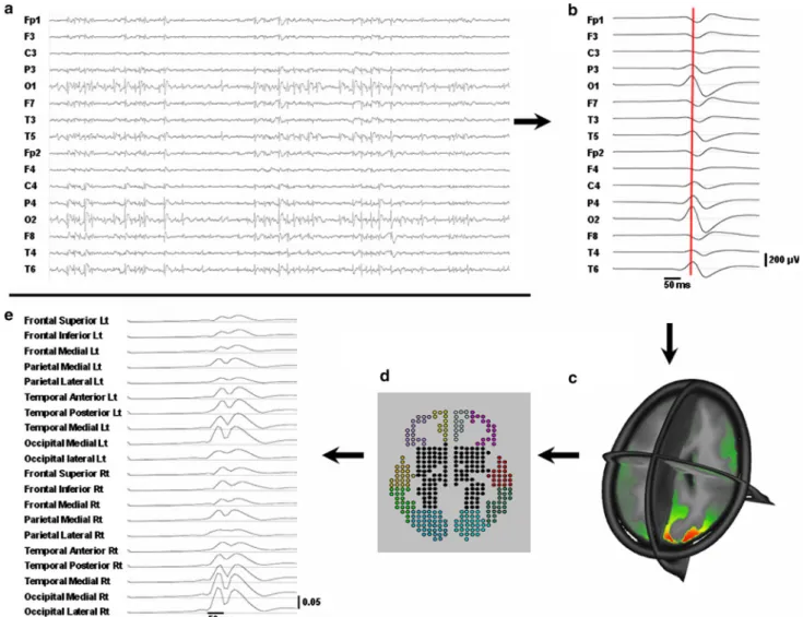 Fig. 1 The analysis procedure. a From the raw EEG spikes are identified. b Several spikes with a similar distribution are averaged.