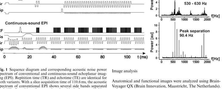 Fig. 1 Sequence diagram and corresponding acoustic noise power spectrum of conventional and continuous-sound echoplanar  imag-ing (EPI)
