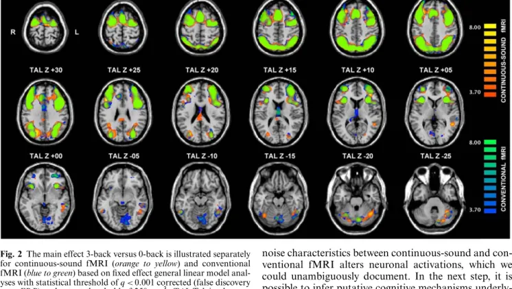 Fig. 2 The main effect 3-back versus 0-back is illustrated separately for continuous-sound fMRI (orange to yellow) and conventional fMRI (blue to green) based on ﬁxed effect general linear model  anal-yses with statistical threshold of q &lt; 0 