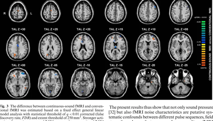 Fig. 3 The difference between continuous-sound fMRI and conven- conven-tional fMRI was estimated based on a ﬁxed effect general linear model analysis with statistical threshold of q < 0 