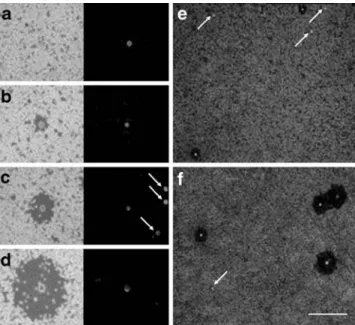 Fig. 2 Effect of glucose on haemolytic plaque formation around single beta cells. One (D1) and five (D5) days after islet isolation, single beta cells were analysed by RHPA