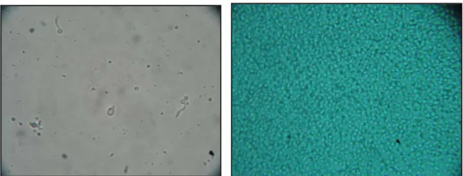 Figure 13 : Résultat microscopique de Rice cream                   Figure 14 : Aspect macroscopique  Objectif 40x 