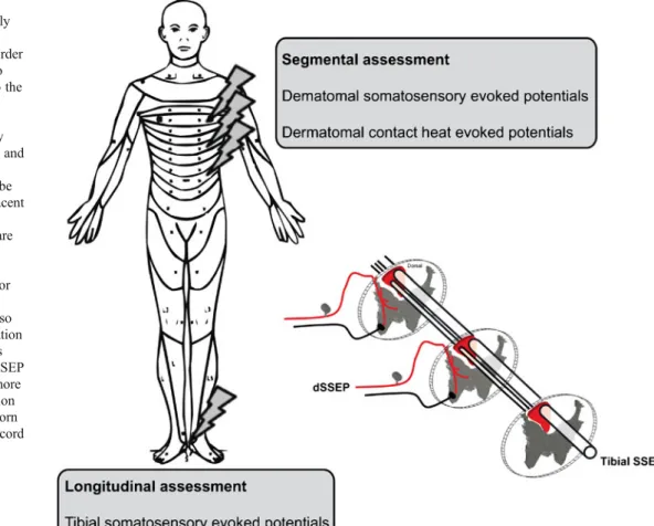 Fig. 2 Neurophysiological measurements are commonly performed by assessing longitudinal pathways