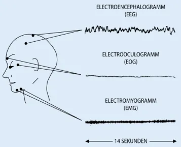 Abb. 1  8   Das Elektroenzephalogramm (EEG) ist die Aufzeichnung von elek- elek-trischen Hirnströmen, das Elektrookulogramm (EOG) von elekelek-trischen  Strö-men, die durch Augenbewegungen entstehen, und das Elektromyogramm  (EMG) von Strömen, die die Musk