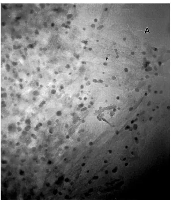 Figure 1. High-resolution transmission electron micrographs of the 5 wt% Pt/alumina catalyst after treatment at 600 ◦ C (same magnification, scaling bar: 7.5 nm)