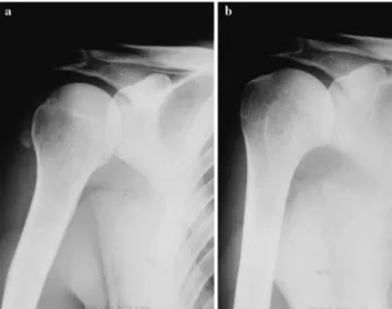 Fig. 1 Typical development of pain according to VAS (range 0–10) at baseline and after medium-energy ESWT