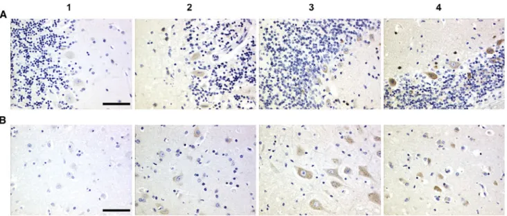 Fig. 1 Immunohistochemical staining for PAP in human brain.