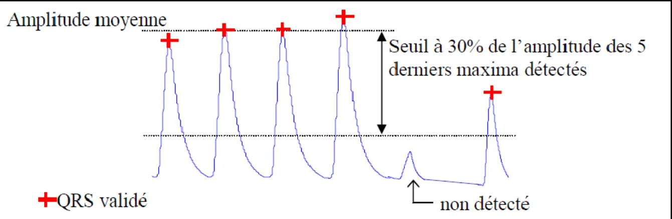 Figure II-10: Exemple d'un seuillage en amplitude et le problème rencontré [34] 