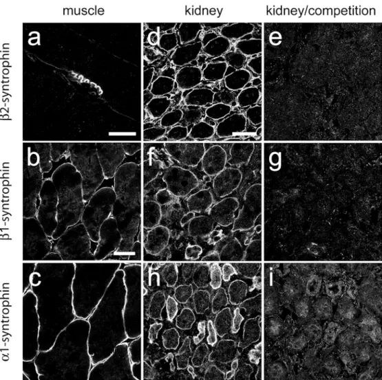 Fig. 1 Specificity test of syn- syn-trophin antisera in adult striated muscle a, b, c, and in kidney in the absence d, f, h or presence e, g, i of peptide antigen (5 μ g/ml) for competition