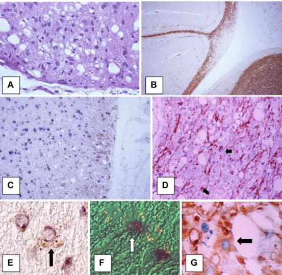 Fig. 2 Acute demyelination in distemper. A At 20 days p.i., acute white matter lesion with vacuolation and astrocytic hypertrophy are seen; hematoxylin and eosin
