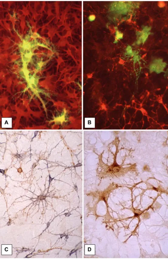 Fig. 3 CDV infection in canine brain cell cultures. A Infection of astrocytes; double