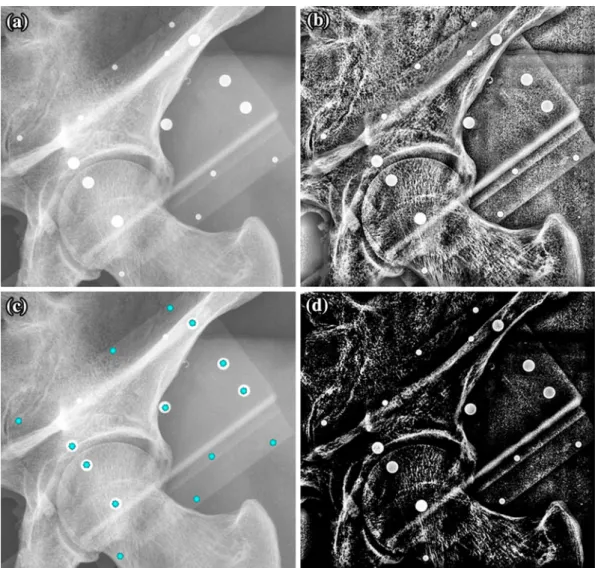 FIGURE 2. Different stages of calibration phantom detection: (a) extracted region of interest; (b) contrast enhanced image using CLAHE algorithm; (c) output of intensity mapping; (d) final detected phantom fiducials.