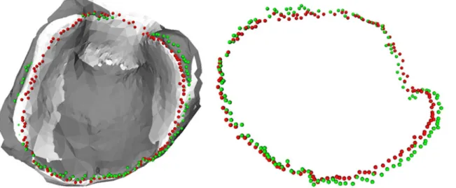 FIGURE 8. Comparison of acetabular rim reconstructions: the rim of the reconstructed model (gray model, green rim contour points) is compared with the ground truth model (white model, red rim contour points).