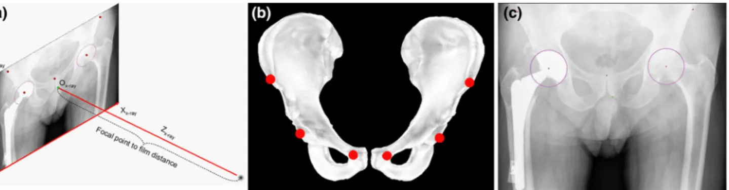 FIGURE 3. Schematic views of establishment of the projection geometry for a given AP X-ray radiograph and of the anatomical landmarks used in the present approach
