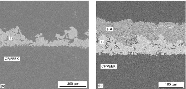 Figure 4 Scanning electron micrographs of cross-sections of (a) VPS-titanium coatings and (b) VPS-hydroxyapatite coatings with an intermediate titanium layer.