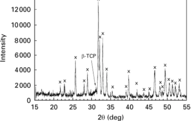 Figure 9 XRD-spectrum of the VPS-HA coatings showing HA ( ] ) as the main component and small concentrations of b -TCP.