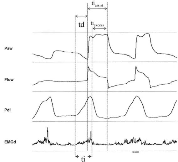 Fig. 1 Representative tracing from a patient, illustrating the various time intervals used.