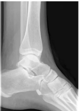 Fig. 1 Lateral radiograph of the footThe diagnosis can be found at doi:10.1007/s00256-011-1116-4.
