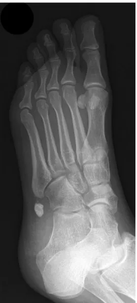 Fig. 3 Oblique radiograph of the foot Fig. 2 Dorsoplantar of the foot