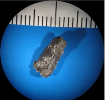 Fig. 5 The largest foreign body was examined and found to be compatible with a projectile fragment