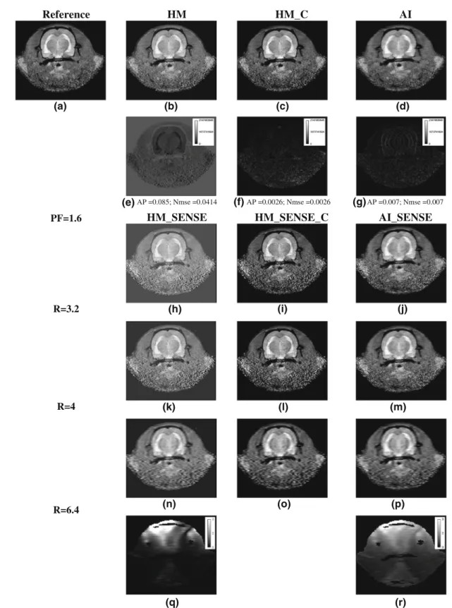 Fig. 3 Reconstruction results from computer simulation on a rat brain data set. The first row represents a reference image reconstructed with full k-space, b–d are images reconstructed with conventional  homo-dyne detection (H M ), constrained HM (HM_C) an