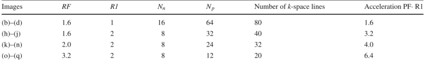 Table 1 Simulation of image acquisition by combining partial k-space with parallel acquisition using 4 receiver coils