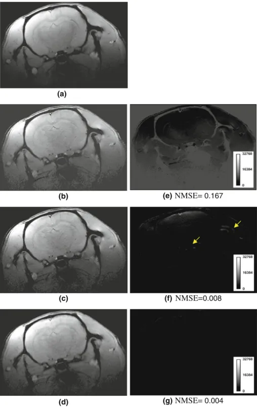 Fig. 5 The left column illustrates the reconstructed brain images from a set of 4-channel a full k-space data using ROEMER reconstruction and subsampled data using b HM_SENSE,